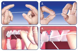 flossing for tooth infection