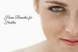 Home Remedies for Freckles