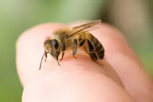 bee sting home remedies