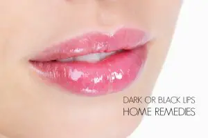 Home Remedies for Dark Lips