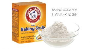 baking soda for canker sore