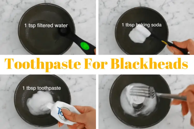 how to remove blackheads at home