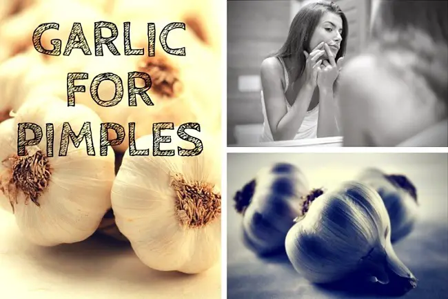 Garlic-for-Pimples