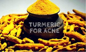 turmeric for acne
