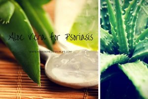 Aloe vera for psoriasis