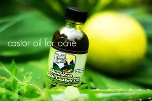 Castor Oil for Acne