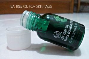 tea tree oil for skin tags