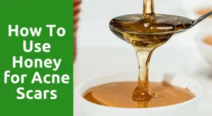 How To Use Honey for Acne Scars