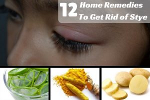 Home Remedies To Get Rid Of Stye