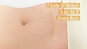 Castor Oil For Stretch Marks