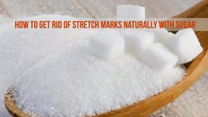 Sugar For Stretch Marks