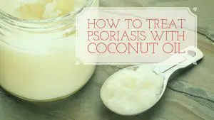Coconut Oil For Psoriasis