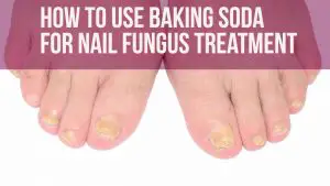 Baking Soda For Nail Fungus