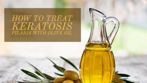 Olive Oil For Keratosis Pilaris