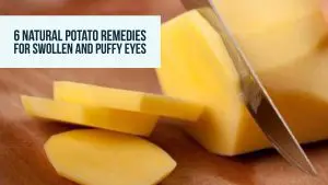 Potato For Puffy Eyes