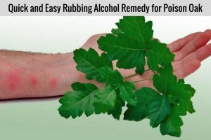 How to Use Rubbing Alcohol to Treat Poison Oak