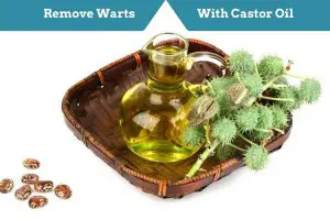 Castor Oil For Warts