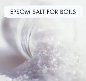 Epsom Salt For Boils