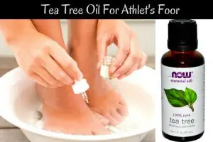 Tea Tree Oil For Athlets Foot