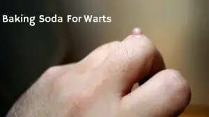 How to Use Baking Soda for Warts