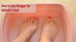 Apple Cider Vinegar for Athlete's Foot