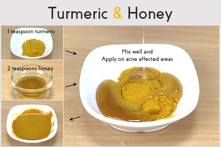 Turmeric And Honey For Acne