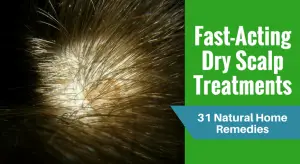 Fast-Acting Dry Scalp Treatments