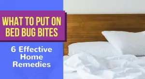 What To Put On Bed Bug Bites