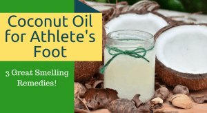 Coconut Oil for Athlete's Foot