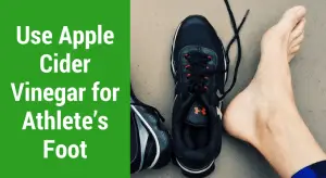 apple cider vinegar for athlete's foot