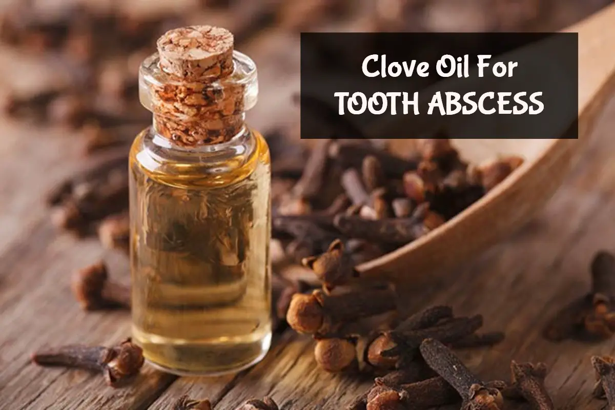 clove oil for tooth abscess