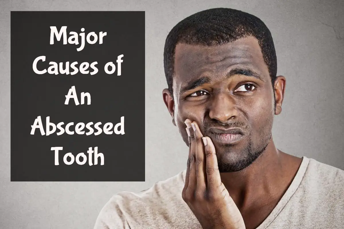major causes of an abscessed tooth