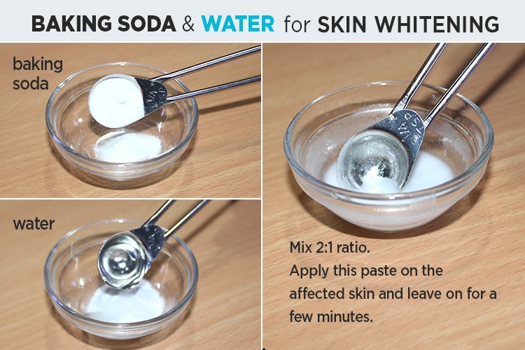 Baking soda and water remedy