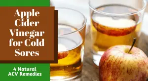 Apple Cider Vinegar for Cold Sores(1)
